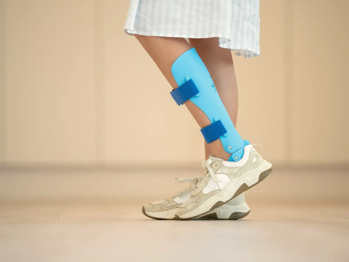 A person walking while wearing a lower-leg orthotic brace during recovery.